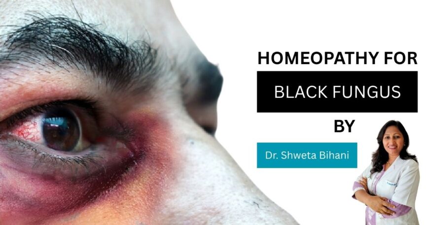 homeopathic medicine for black fungus