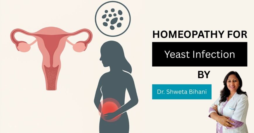 homeopathic medicines for yeast infection