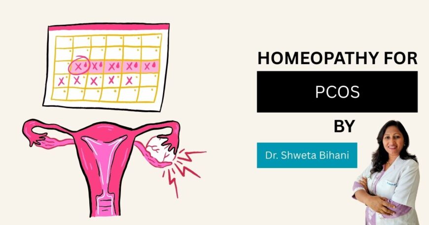 homeopathic remedies for pcos